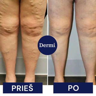 EMS Pėdų Masažuoklis