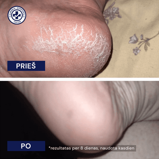 Drėkinamosios kojinės sausai odai
